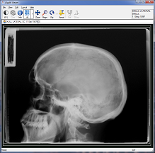 very simple free dicom viewer very simple free dicom viewer